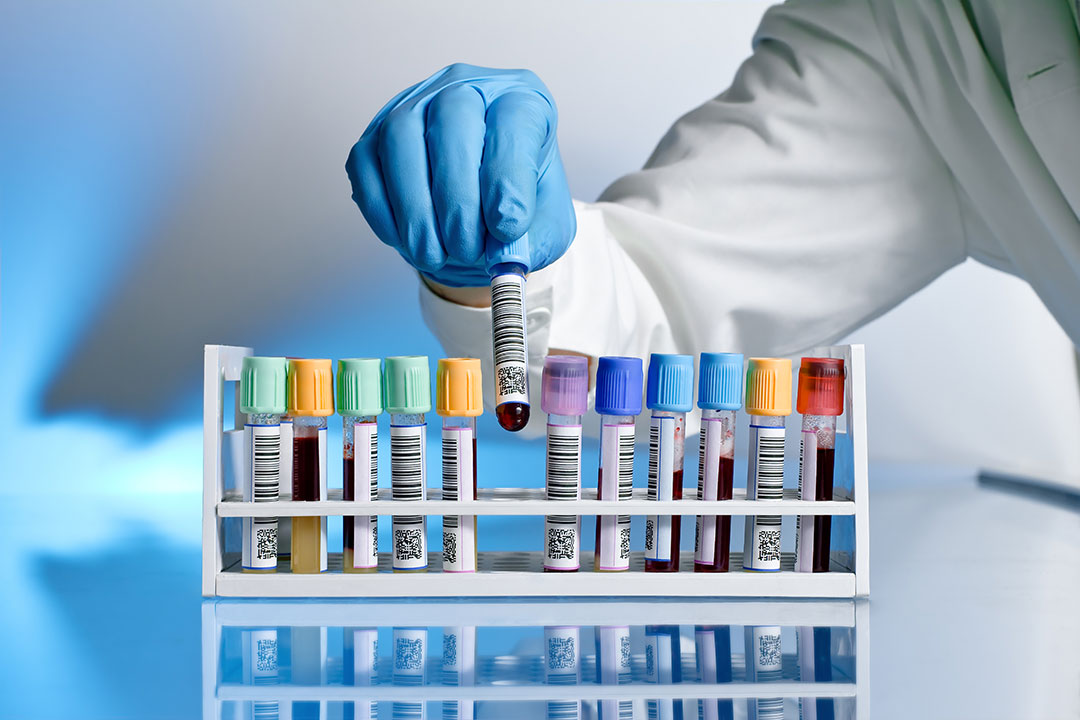 blood_samples_lab